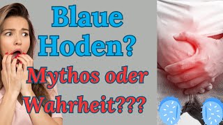 Mythos oder Wahrheit Blaue Hoden bei Männern 🤷‍♀️ Ratgeber Funken der Liebe 💘 [upl. by Martreb]