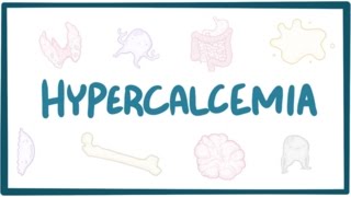 Hypercalcemia  causes symptoms diagnosis treatment pathology [upl. by Asikal]