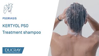 KERTYOL PSO Treatment shampoo for psoriasisprone scalps [upl. by Ody]