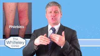 Phlebitis  What is phlebitis and how should phlebitis be treated [upl. by Malilliw73]