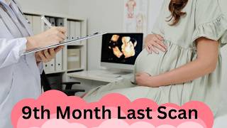 9th Month Pregnancy Ultrasound Last Scan Before Baby’s Arrival pregnancy pregnant dailyvlog [upl. by Terriss916]