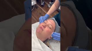 Have You Heard of A MANDELIC PEEL LEARN MORE ABOUT IT skincare treatment viralvideo shorts [upl. by Lashond495]