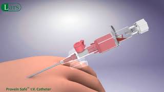 IV Cannula Safety [upl. by Amis]