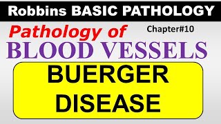 Ch10  BUERGER DISEASE  Blood Vessel Pathology  Robbins Lectures [upl. by Enirhtac]