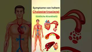 Symptome von hohem cholesterinspiegel [upl. by Acinorahs]