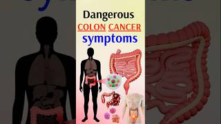 Cancer Symptoms You Should NEVER Ignore [upl. by Berliner432]