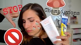 Des champignons sur le visage  Problèmes de peau ma solution [upl. by Yezdnil]