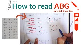 How to check ABG or arterial blood gas  ABG Interpretation [upl. by Backler]