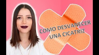 ¿Cómo desvanecer una cicatriz Cicatricure funciona  Story Time  Lylocyv [upl. by Suoivatnod592]