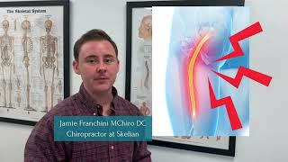 Top 3 Causes Of Sciatica Explained By MSK Expert [upl. by Kassaraba]