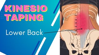 Lumbar spine or Sacroiliac Joint pain  try Kinesiology Taping technique using Rocktape Big Daddy [upl. by Auhsoj]