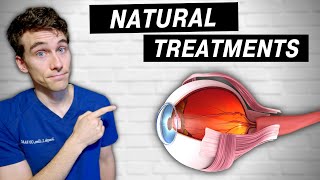 7 Natural Ways to Prevent amp Treat Glaucoma  QampA [upl. by Swords]