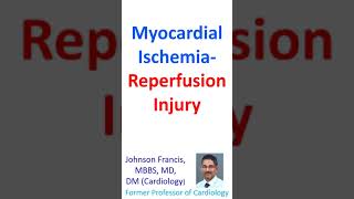 Myocardial IschemiaReperfusion Injury [upl. by Ravert]