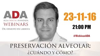 WebinarADA Preservación Alveolar [upl. by Hare]