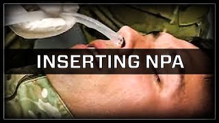 Inserting a Nasopharyngeal Airway NPA [upl. by Casi]