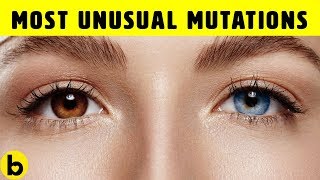 10 Unusual Genetic Mutations Of The Human Body [upl. by Malarkey]