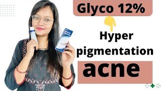 Glyco 12  for acne amp hyperpigmentation  honest review [upl. by Anaitat]