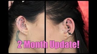 Helix Piercings 2 Month Update  MASSIVE KELOIDS [upl. by Stets]