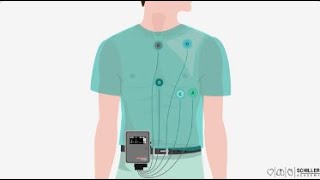 SCHILLER Holter Monitoring [upl. by Nnylylloh]