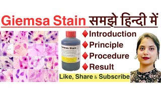 Giemsa stain in Hindi  principle  procedure  result  MLT  histopathology  Haematology [upl. by Ayortal]