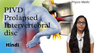 Introduction  Prolapsed Intervertebral DiscPIVD  Made Easy  Hindi  Part 1 Back Pain [upl. by Fira632]