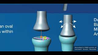 Condyloid amp Ellipsoid synovial joints [upl. by Atteval320]