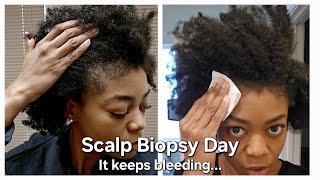 Scalp Biopsy Day—It Keeps Bleeding  Type 4 Natural Hair  4C Hair  HD 1080p [upl. by Varhol]