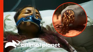 Tick Bite Infects Woman With Rare Parasites  Monsters Inside Me [upl. by Esidnak]