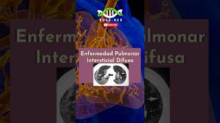 ENFERMEDAD PULMONAR INTERSTICIAL DIFUSA EN 1 Min salud medico doctor mrdoctor pulmones [upl. by Zenia]