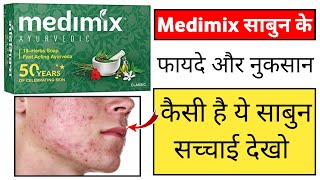 Medimix Soap Review In Hindi  medimix sabun ke fayde [upl. by Melquist]