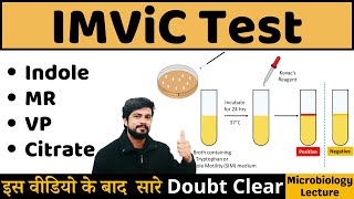 IMViC Test  Indole MR VP Citrate Utilization Test  IMViC Test Procedure in Microbiology [upl. by Nylirem]