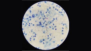 Sputum Test AFB StainingMLT PRACTICAL [upl. by Astri]