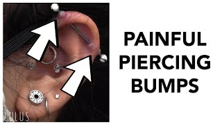 If You Do This You Will Get Piercing Bumps Testimonial [upl. by Feldman372]