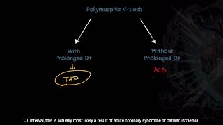 Differentiating between Ventricular Tachycardia VTach and Torsades de Pointes  Good Reads Ep 6 [upl. by Ern462]