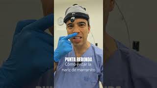 Cómo evitar la nariz de marranito cirugiadenariz rinoplastia nosejob [upl. by Dallis]