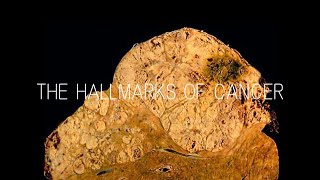 The Hallmarks of Cancer [upl. by Naxor]