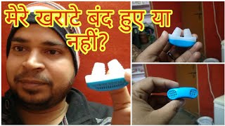 खर्राटे रोकने का इलाज  Anti snoring device for men  kharate ka ilaj in hindi  kharate kaise roke [upl. by Nahij]