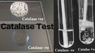 Catalase Test [upl. by Eidualc833]