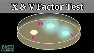 X amp V Factor Test  X V XV Factor Test For Haemophilus Influenzae [upl. by Pauli]