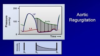 Cardiac Auscultation [upl. by Yerffoj]