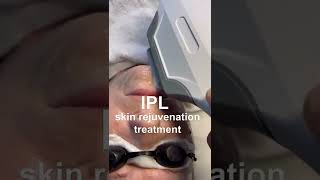 IPL Skin Rejuvenation Treatment  estheticsnyc [upl. by Edra145]