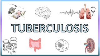 Tuberculosis  Types Pathogenesis Signs and Symptoms Diagnosis Treatment and Prevention [upl. by Hserus]