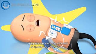 Thiết bị AED dùng để làm gì What does an AED do [upl. by Azpurua]