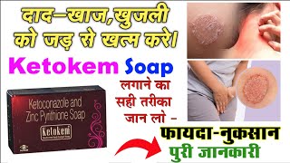 ketokem soap uses in hindi  ketokem soap review  ketoconazole zinc pyrithione soap ketodila [upl. by Etnaled]