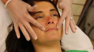 IPL Therapy  Melasma [upl. by Utica]