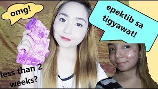 Effective ba sa Pimples ang Myra Lactezin [upl. by Bunting620]