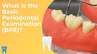 Basic Periodontal Examination BPE  What Why and How [upl. by Hadeis]