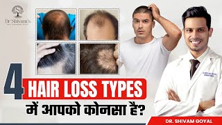 4 Common Hair Loss Types and How to Treat Them हिंदी में  Types of Hair Loss  Dr Shivam Goyal [upl. by Tammie]