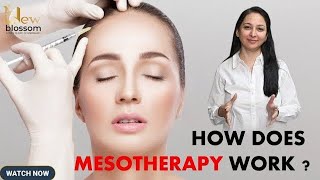 Mesotherapy for skin  How mesotherapy work [upl. by Myer]