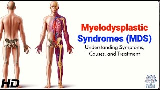 Myelodysplastic Syndromes MDS Symptoms Diagnosis and Treatment [upl. by Alvin]